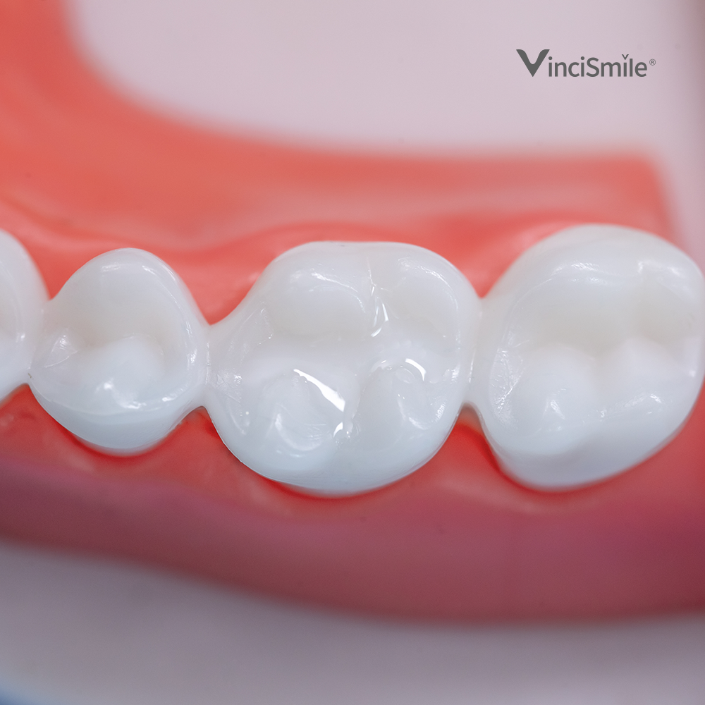 Proseal F Enamel Coating Resin