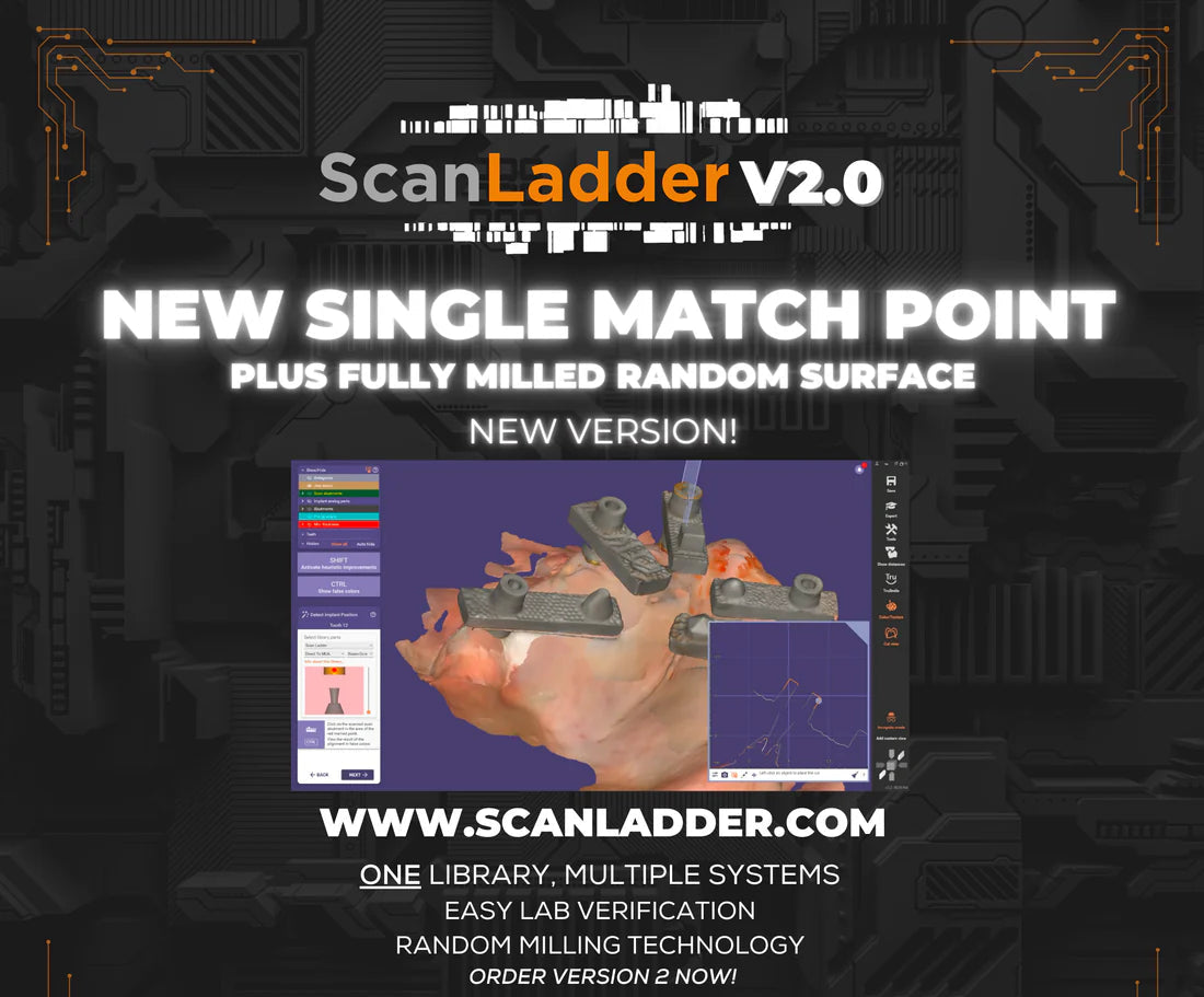 Scan Ladder Titanium Direct Kit