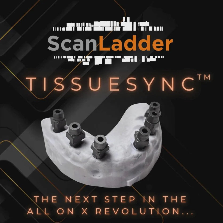 Scan Ladder TissueSync Scanbody Set