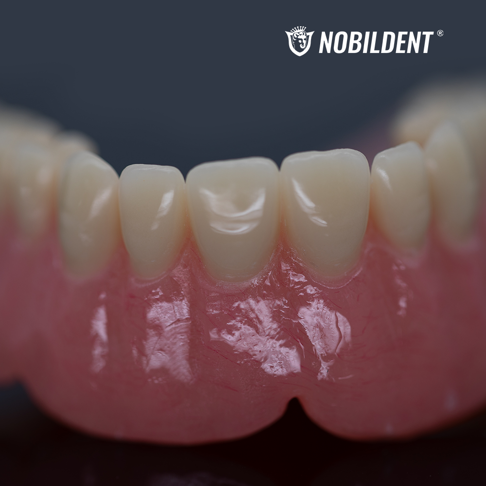 Denture Base Polymer & Liquid