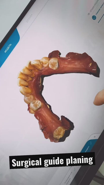 Dental Surgical Guide Resin