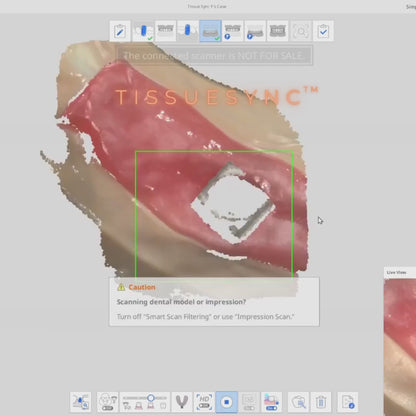 Scan Ladder TissueSync Scanbody Set
