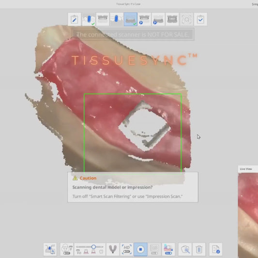 Scan Ladder TissueSync Scanbody Set